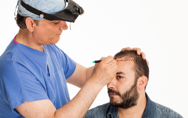 https://services.enfieldroyalsydney.com/wp-content/uploads/2022/09/hair-transplant-768x480.webp